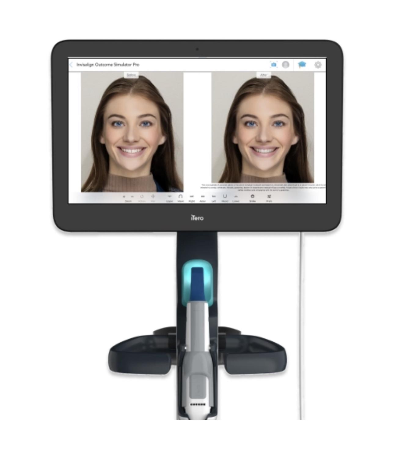 woman smiling after taking pictures with iTero digital impression system